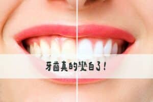 經過這次體驗，我忍不住要做個比較表給大家參考： 從我個人的體驗來說，白凝最大的優勢就是無酸痛感。傳統冷光美白因為使用的是過氧化氫，如果是牙齒敏感的族群可能會覺得比較刺激。 操作時間短也是很大的加分項。現代人生活這麼忙碌，能在30分鐘內完成美齒療程真的很方便。而且無飲食限制對我這種吃貨來說根本是福音，不用為了維持美白效果而犧牲美食享受。 我體驗玩白凝美齒之後，就直接去附近吃了一碗牛肉麵啦！