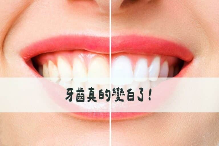 經過這次體驗，我忍不住要做個比較表給大家參考： 從我個人的體驗來說，白凝最大的優勢就是無酸痛感。傳統冷光美白因為使用的是過氧化氫，如果是牙齒敏感的族群可能會覺得比較刺激。 操作時間短也是很大的加分項。現代人生活這麼忙碌，能在30分鐘內完成美齒療程真的很方便。而且無飲食限制對我這種吃貨來說根本是福音，不用為了維持美白效果而犧牲美食享受。 我體驗玩白凝美齒之後，就直接去附近吃了一碗牛肉麵啦！